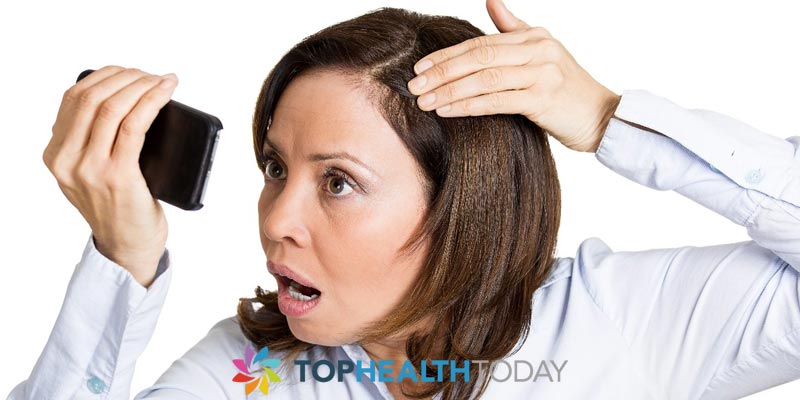 What is female pattern hair loss?