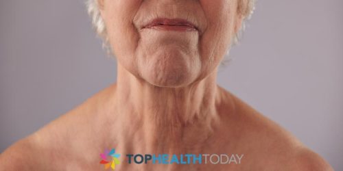 What Causes Saggy Neck Skin Top Health Today 